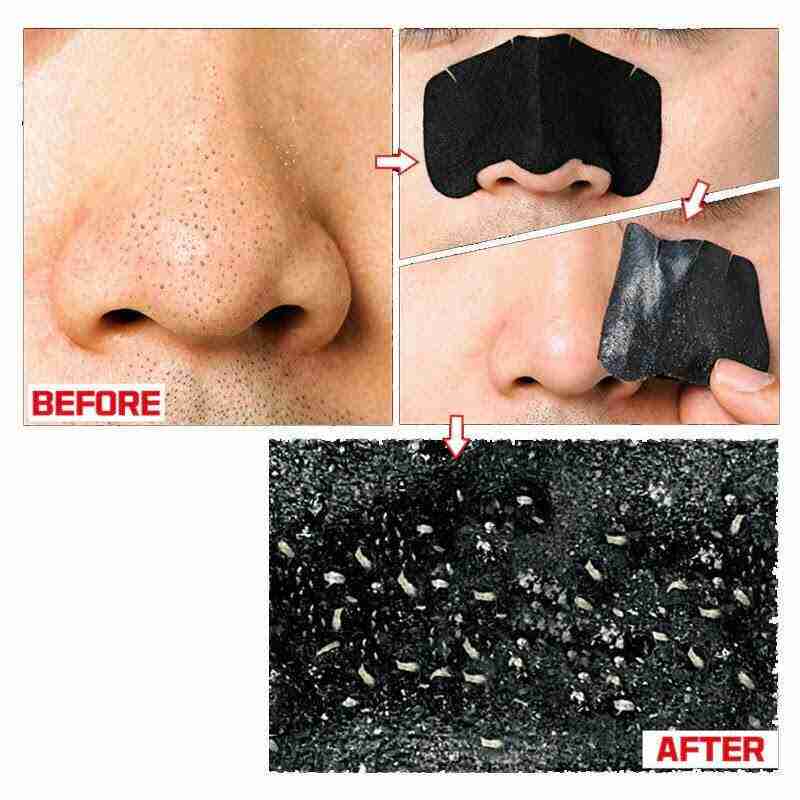 Before and after use pig nose patch strong holika holika